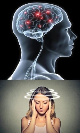 cogniclear-brain-supplement